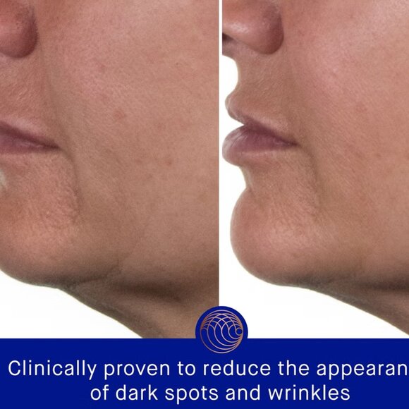 Augustinus Bader The Rich Cream 15ML - Picture 3 of 4